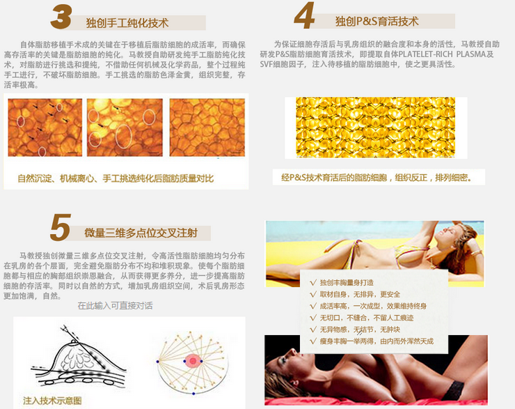 马梅生自体脂肪隆胸技术 马梅生自体脂肪隆胸技术