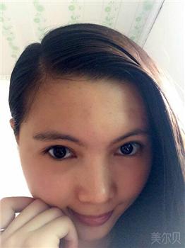 术后 术后