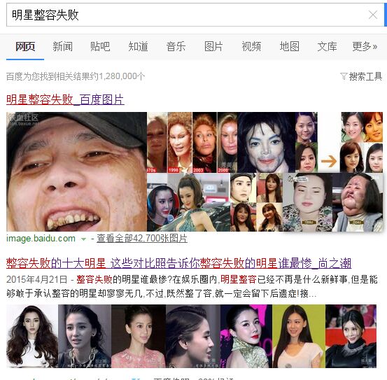 明星整容失败 明星整容失败