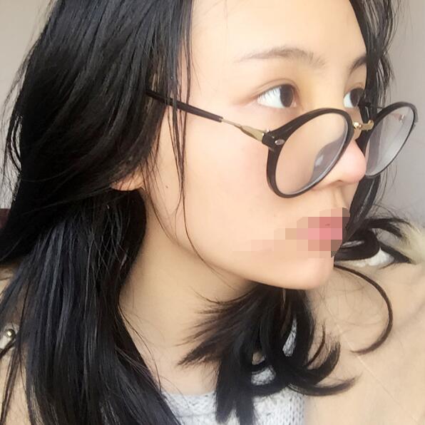 武汉隆鼻案例 武汉隆鼻案例