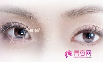 成都军大,双眼皮,怎么样?价格案例分享