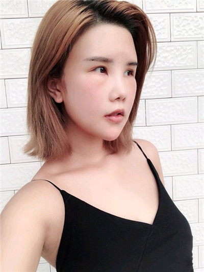 重庆铂生,杜亚旭,面部填充,案例,价格,