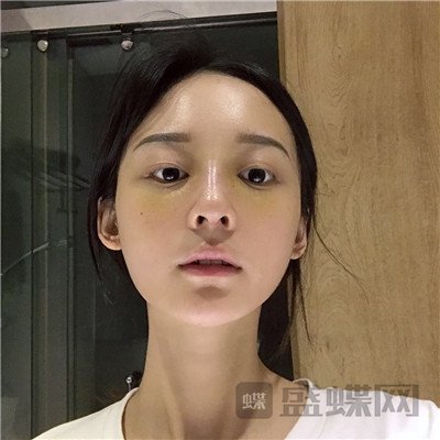 上海百达丽,沈国雄,隆鼻,案例,价格,