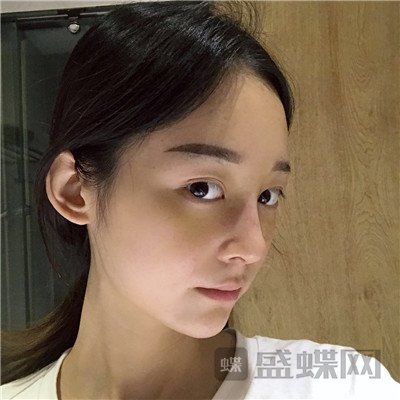 上海百达丽,沈国雄,隆鼻,案例,价格,