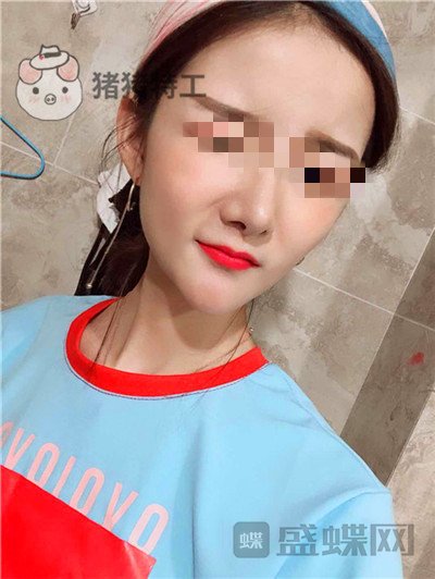 福州美贝尔,原上海九院,赵栋材,面部填充,案例,价格,