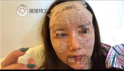福州美贝尔,原上海九院,赵栋材,面部填充,案例,价格,