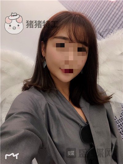 北京俊泰丽格,薛志强,埋线提升,案例,价格,