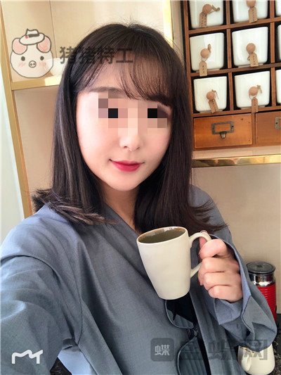 北京俊泰丽格,薛志强,埋线提升,案例,价格,