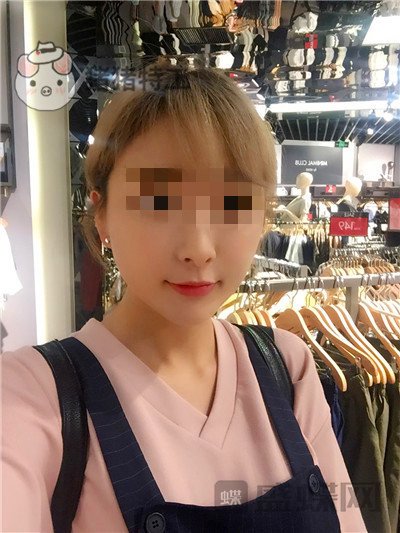 北京俊泰丽格,薛志强,埋线提升,案例,价格,