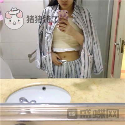 重庆五洲,魏恒,隆胸,案例,价格,