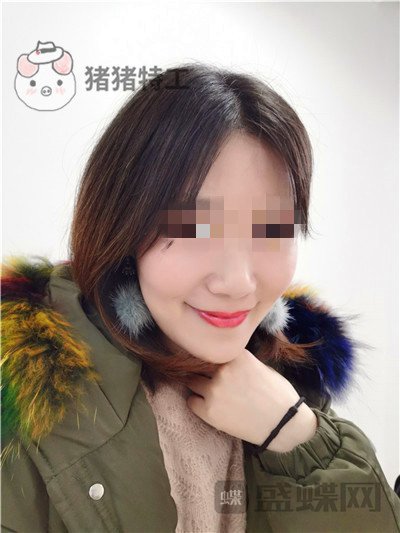 重庆华美,陈凯,面部填充,案例,价格,
