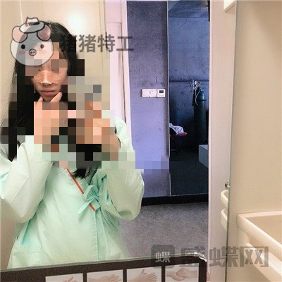 长沙艺星,秦晓东,隆鼻,案例,价格,