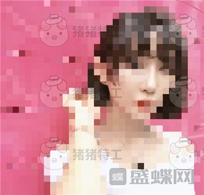 上海九院,张盈帆,鼻修复,案例,价格,