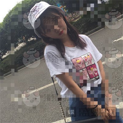 重庆万家燕,王珍祥,颧骨内推,案例,价格,