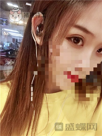 杭州美莱,韩超,双眼皮,案例,价格,