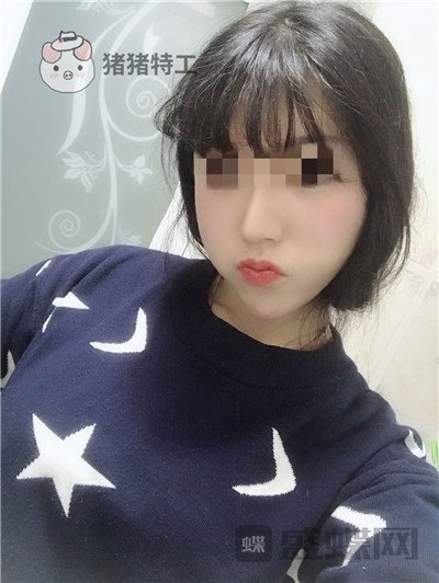 北京润美玉之光,王明利,面部填充,案例,价格,