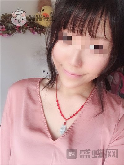 北京润美玉之光,王明利,面部填充,案例,价格,