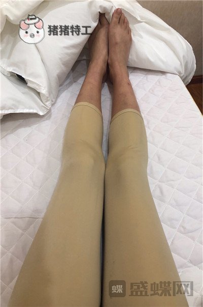 昆明梦想整形,李成龙,吸脂,案例,价格,