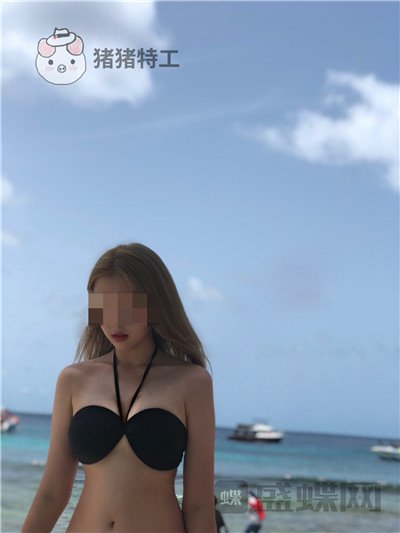 深圳阳光,罗志敏,隆胸,案例,价格,