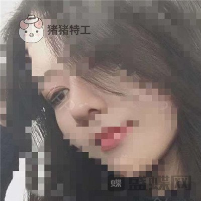 上海百达丽,周珍艳,双眼皮,鼻部手术,案例,价格,