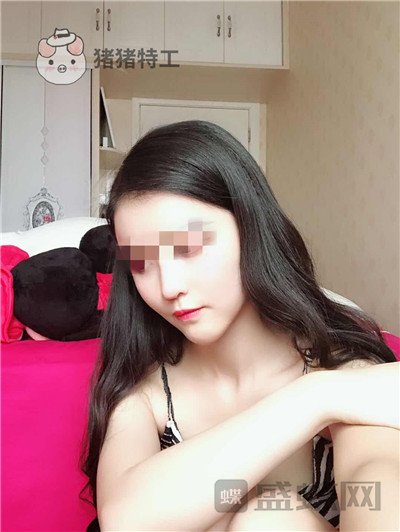 上海华美,李健,面部填充,案例,价格,