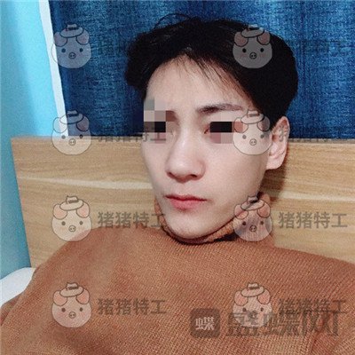 北京长虹,于志宏,鼻部手术,案例,价格,