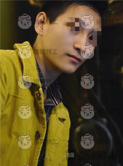 北京长虹,于志宏,鼻部手术,案例,价格,