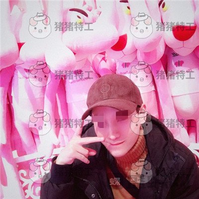 北京长虹,于志宏,鼻部手术,案例,价格,