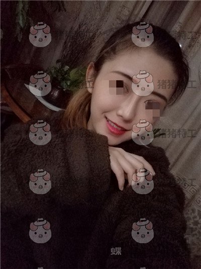 重庆新铜雀台,鹏,隆鼻,案例,价格,