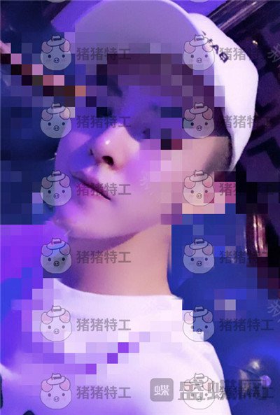 上海华美,叶丽萍,垫下巴,案例,价格,