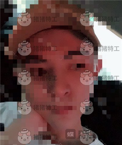 上海华美,叶丽萍,垫下巴,案例,价格,