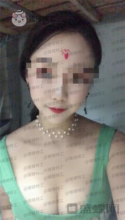 南京美贝尔,黄名斗,隆胸,案例,价格,