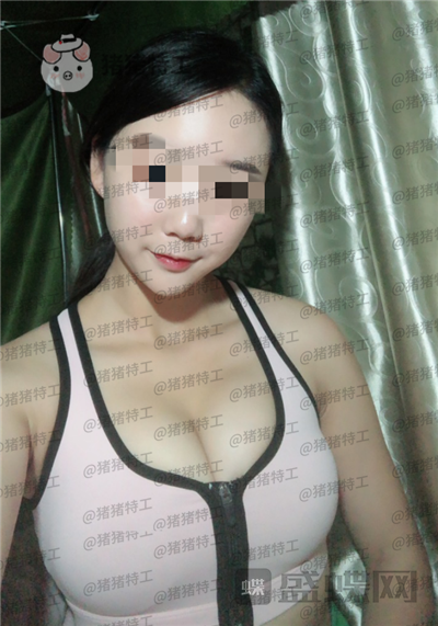 南京美贝尔,黄名斗,隆胸,案例,价格,
