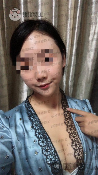 南京美贝尔,黄名斗,隆胸,案例,价格,
