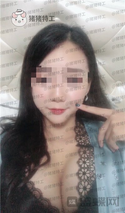 南京美贝尔,黄名斗,隆胸,案例,价格,