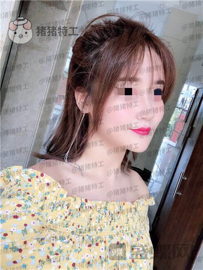 北京玲珑梵宫,张燕雄,隆鼻,案例,价格,