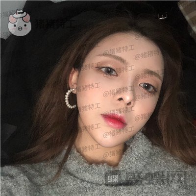 重庆华美,潘宝华,颧骨整形,案例,价格,