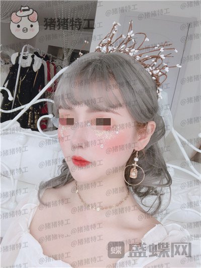 四川华人医联,张淼,鼻部手术,案例,价格,