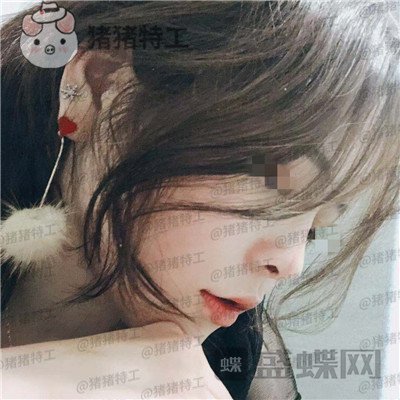 成都西区医院,车红昌,隆鼻,案例,价格,