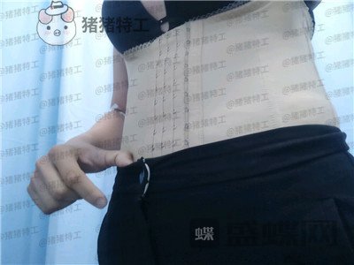 上海九院,濮哲铭,吸脂,案例,价格,