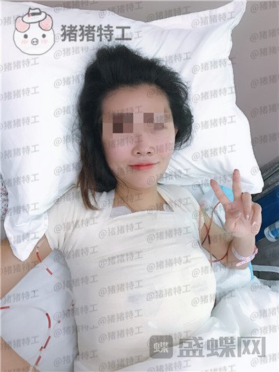 北京美莱,董岩岩,隆胸,案例,价格,
