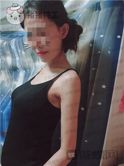 北京美莱,董岩岩,隆胸,案例,价格,
