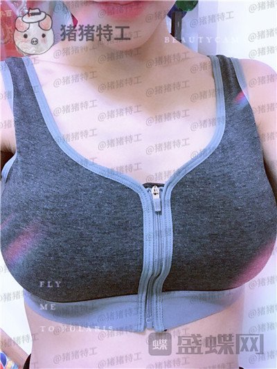 北京美莱,董岩岩,隆胸,案例,价格,