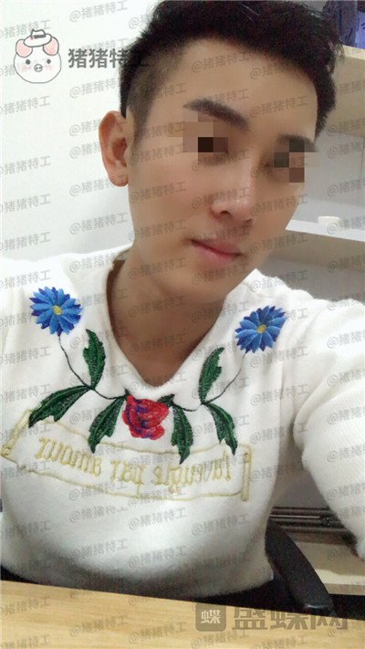 深圳艾妍,徐荣阳,隆鼻,案例,价格,