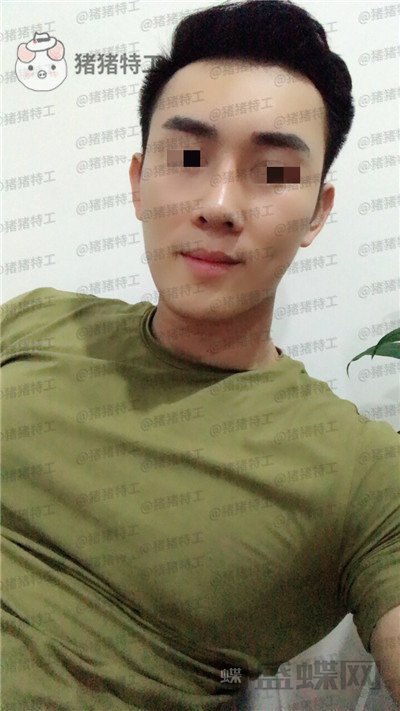 深圳艾妍,徐荣阳,隆鼻,案例,价格,