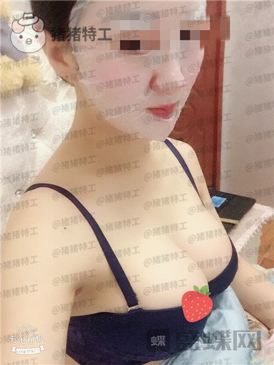 重庆五洲,魏恒,隆胸,案例,价格,