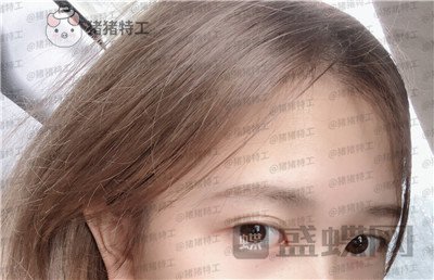 广东画美,牟北平,双眼皮,案例,价格,