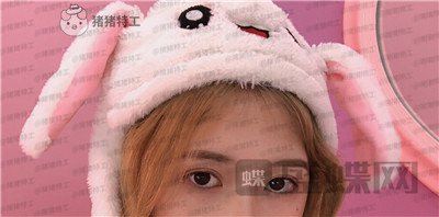 广东画美,牟北平,双眼皮,案例,价格,
