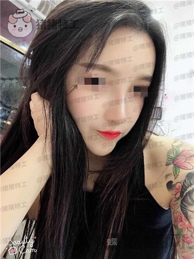 重庆华美,蒋琳,隆鼻,案例,价格,
