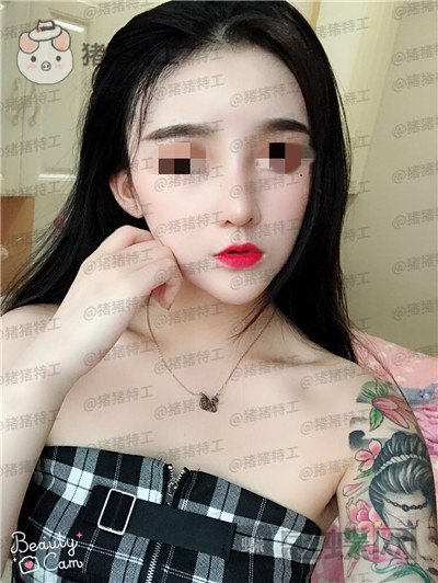 重庆华美,蒋琳,隆鼻,案例,价格,